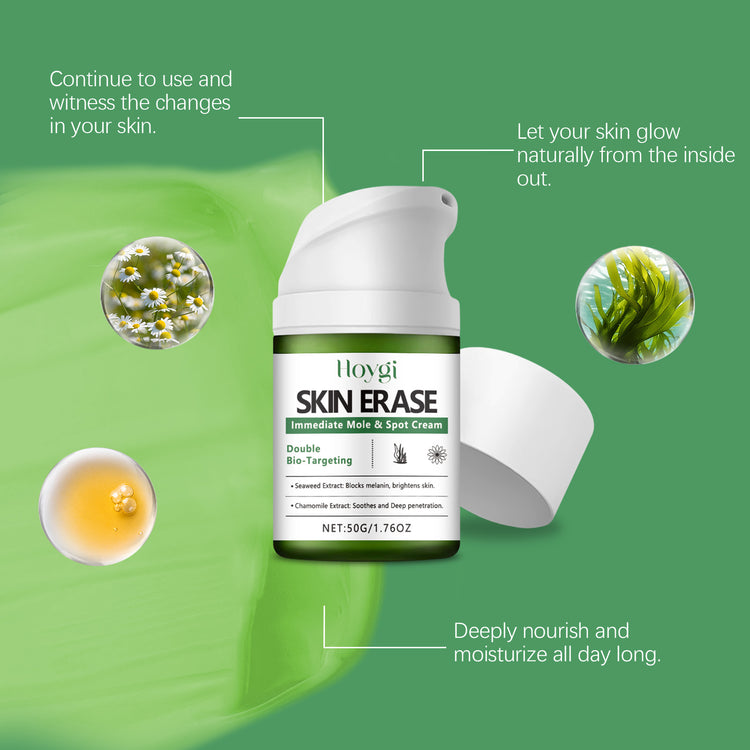 Hoygi Skin Erase Cream – 50 g
