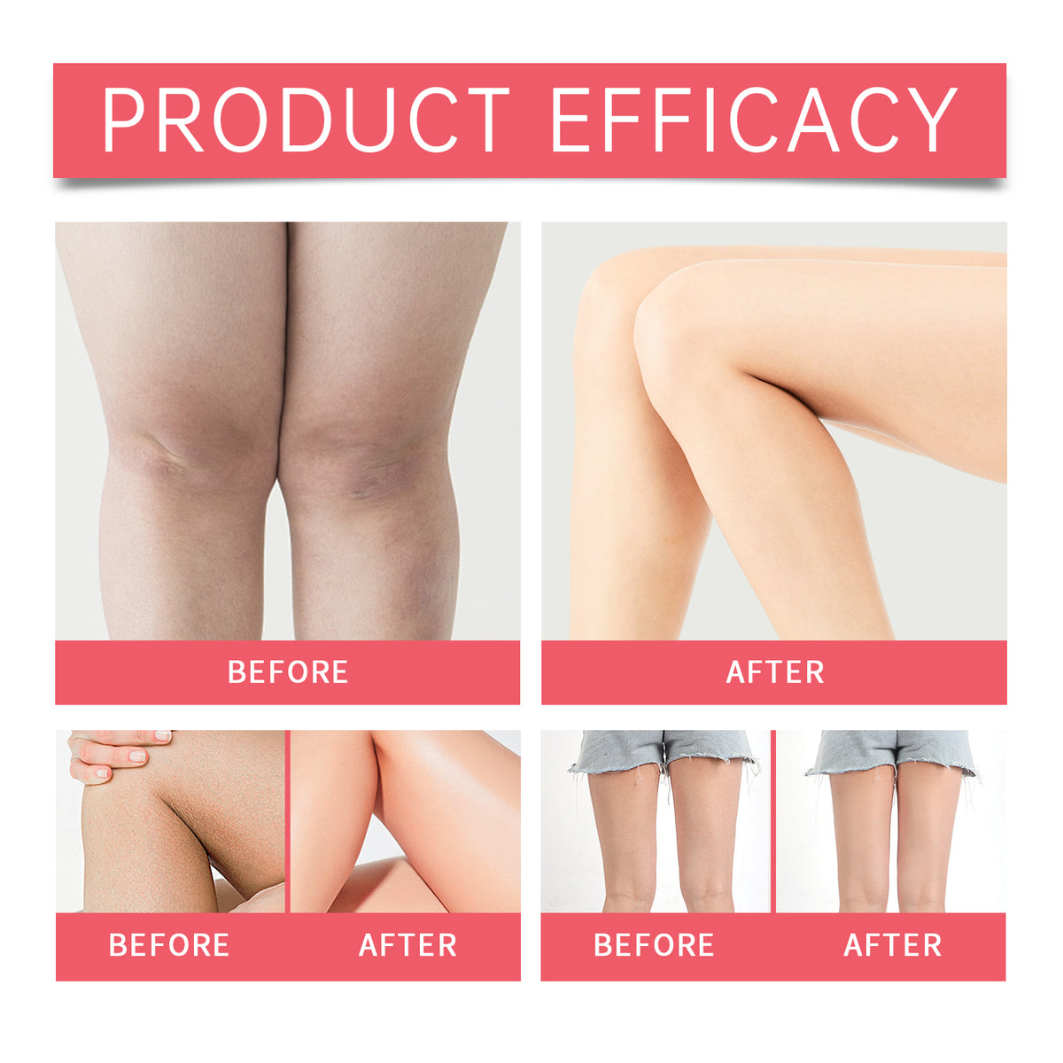 EELHOE Thigh Care Essence Lotion Gently Nourishes The Skin On The Legs, Making Them Tender And Light, And Protects The Legs With Essence