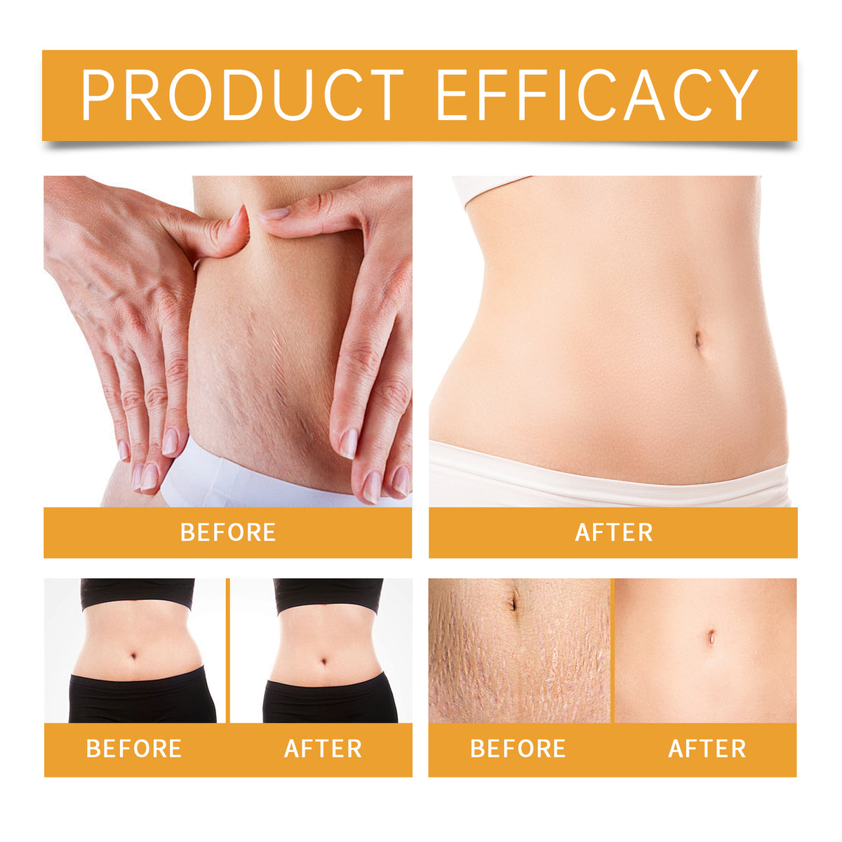 EELHOE Abdominal Essence Lotion Gently Nourishes The Skin, Making It Smooth And Hydrating. Carry It With You And Massage Your Body