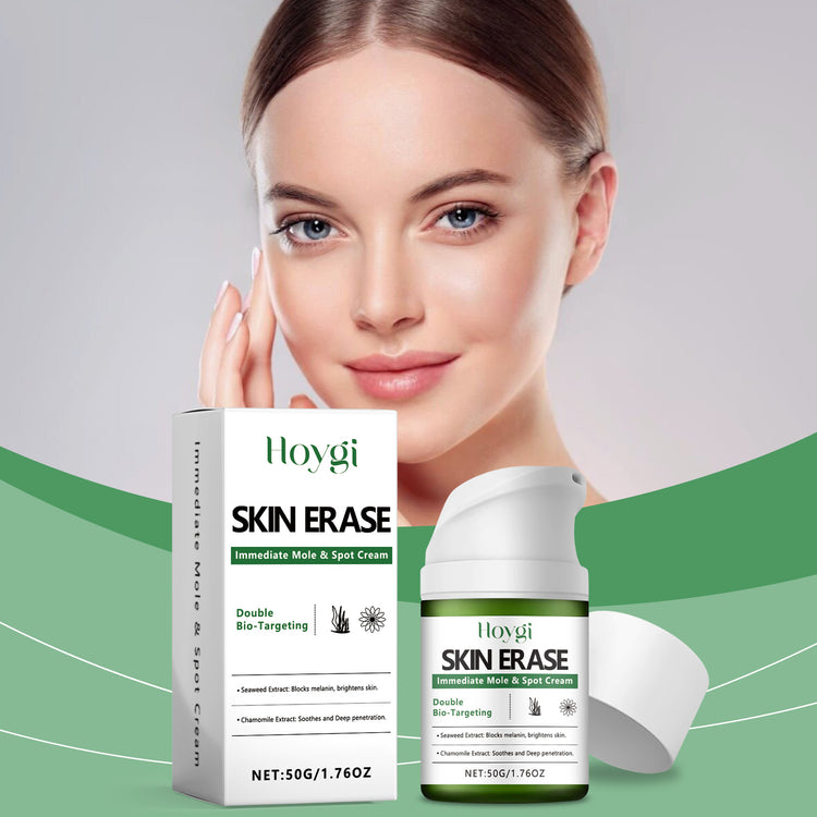Hoygi Skin Erase Cream – 50 g