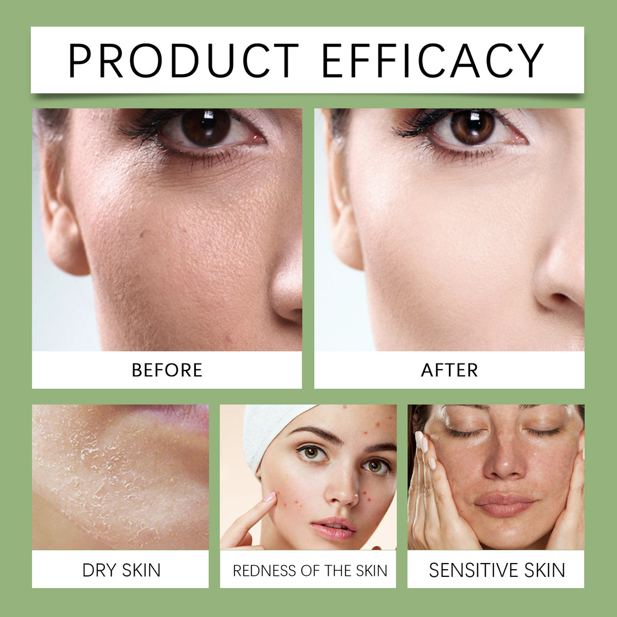 OceAura Moisturizing Aloe Vera Gel Moisturizes And Nourishes Skin After Sun