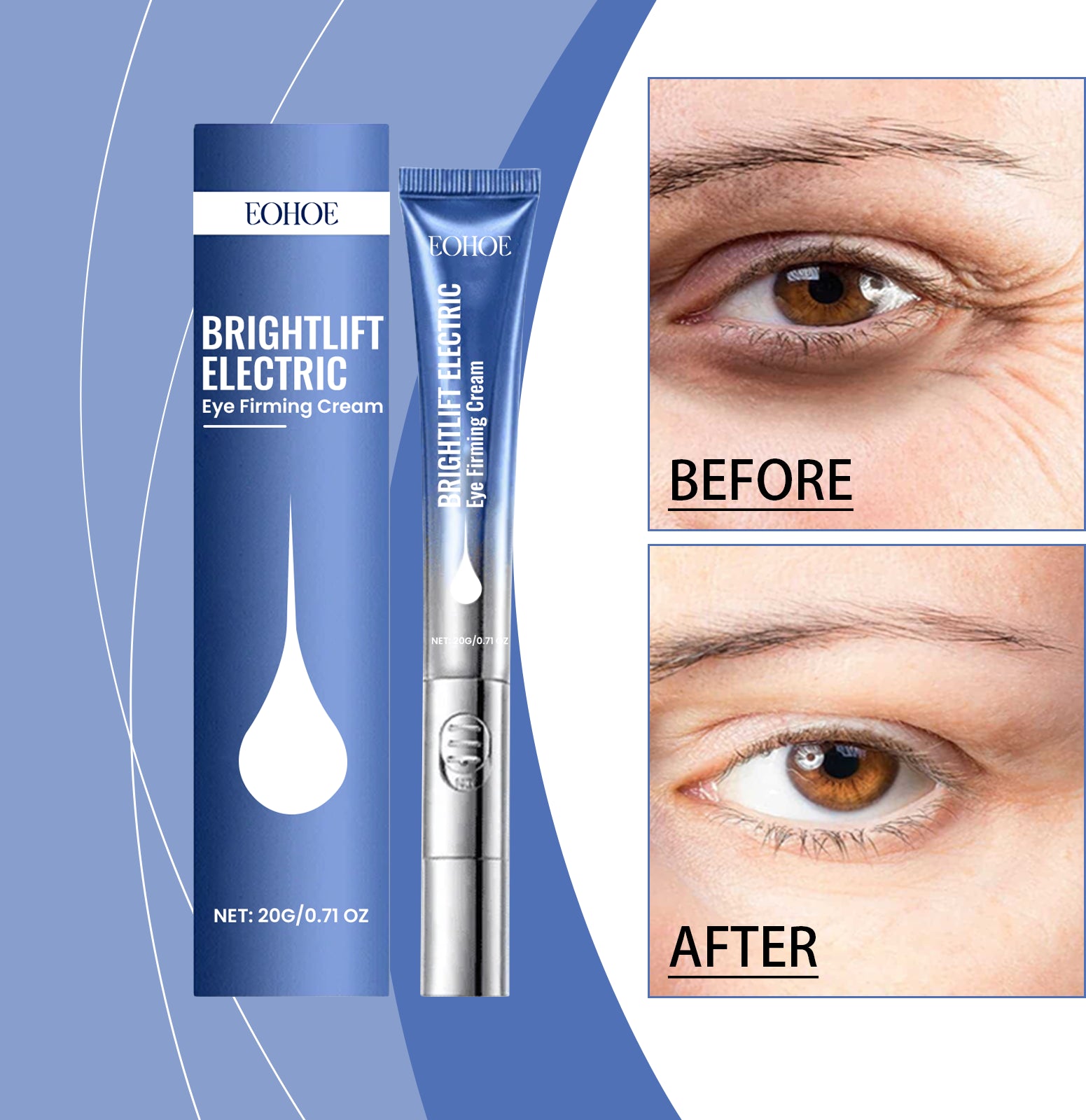 EOHOE Electric Eye Cream Gently Moisturizes And Cares For The Eyes, Nourishing And Softening The Skin Around The Eyes. Daily Care Eye Cream