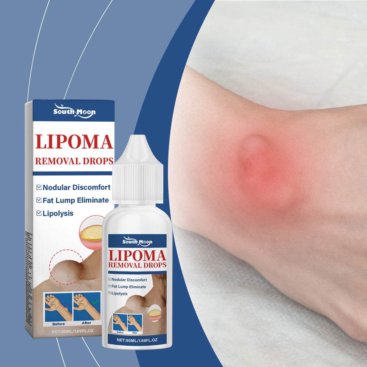 South Moon Body Care Drops Gently Remove Clumps And Repair The Back Of Legs To Restore Smooth Body